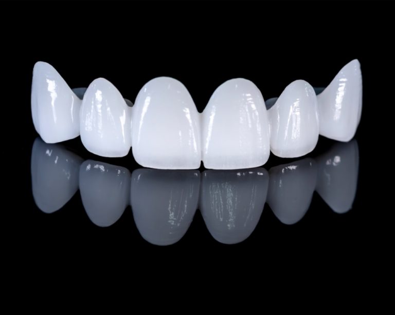 Răng sứ Cercon HT