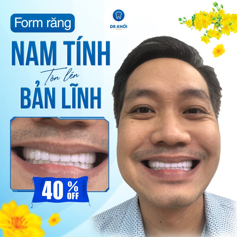 Ưu đãi Implant Nha Khoa Dr Khởi