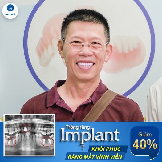Khách hàng implant tại Nha Khoa Dr Khởi