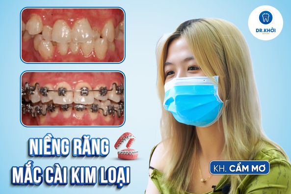 Khách hàng niềng răng tại Nha Khoa Dr Khởi