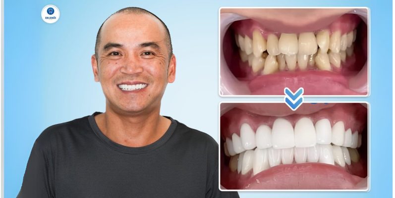 Khách hàng răng sứ tại Nha Khoa Dr Khởi