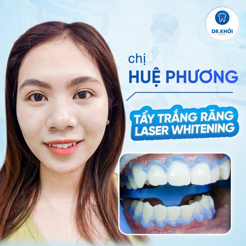 Khách hàng nha khoa tổng quát tại Nha Khoa Dr Khởi