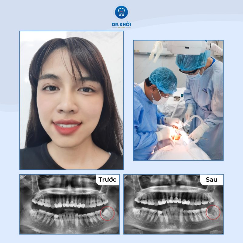 Khách hàng nha khoa tổng quát tại Nha Khoa Dr Khởi