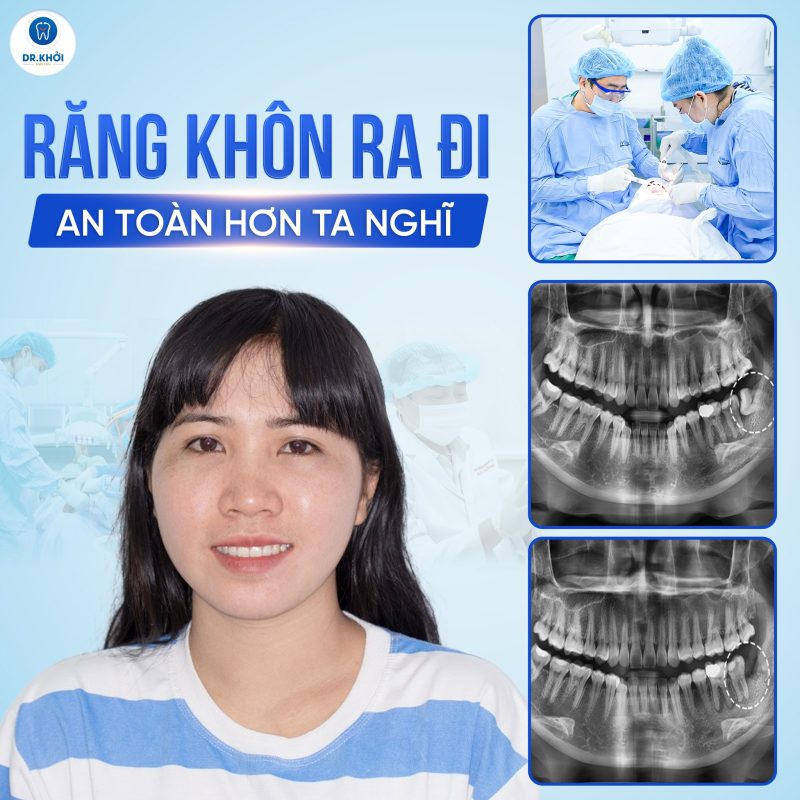 Khách hàng nha khoa tổng quát tại Nha Khoa Dr Khởi