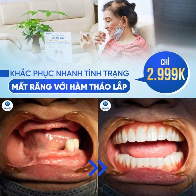 Khách hàng nha khoa tổng quát tại Nha Khoa Dr Khởi