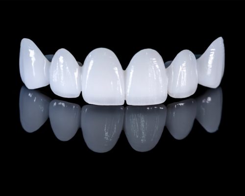 Răng sứ Cercon HT