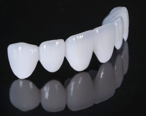 Răng sứ Lava Plus