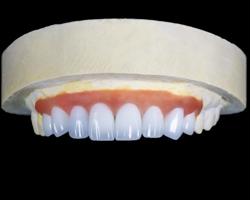 Răng sứ Orodent