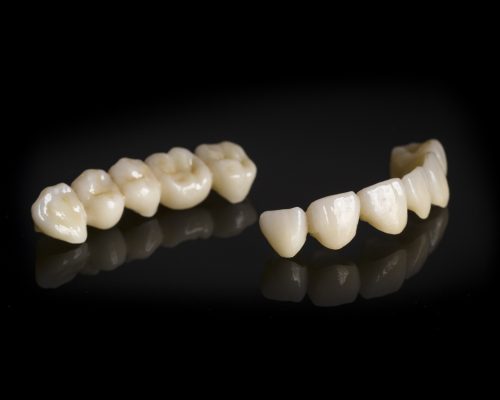 Răng sứ không kim loại (Zirconia)