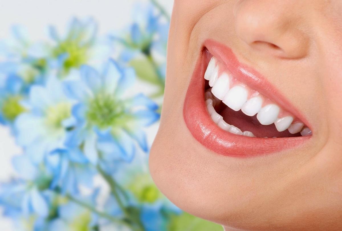 Bọc răng sứ kiểu răng thỏ che phủ khuyết điểm răng thật