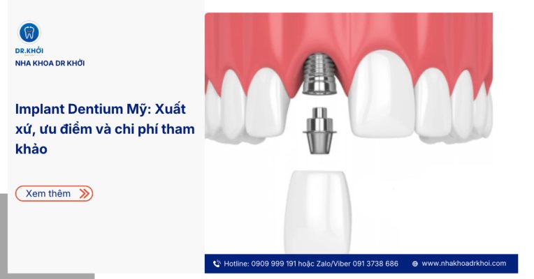 Implant Dentium Mỹ - trụ Implant nhập khẩu từ Mỹ đạt chuẩn FDA và CE