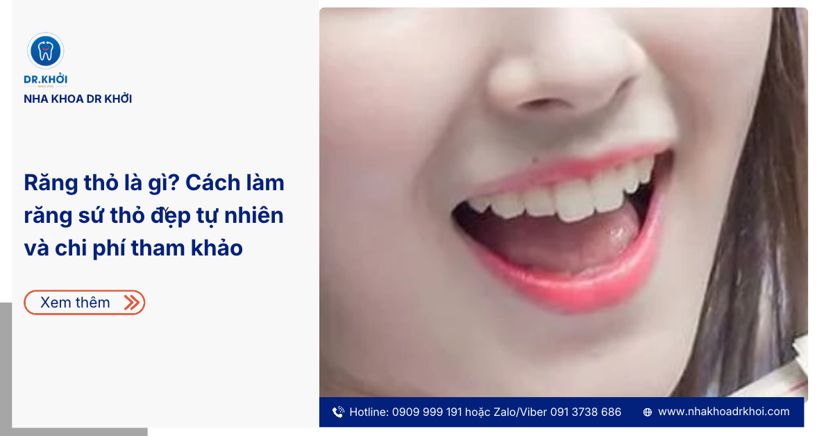 Răng thỏ là gì? Cách làm răng sứ thỏ đẹp tự nhiên và chi phí tham khảo
