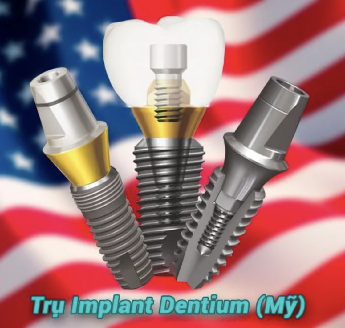 Ưu điểm của Implant Dentium Mỹ: tích hợp xương nhanh, vật liệu titanium an toàn